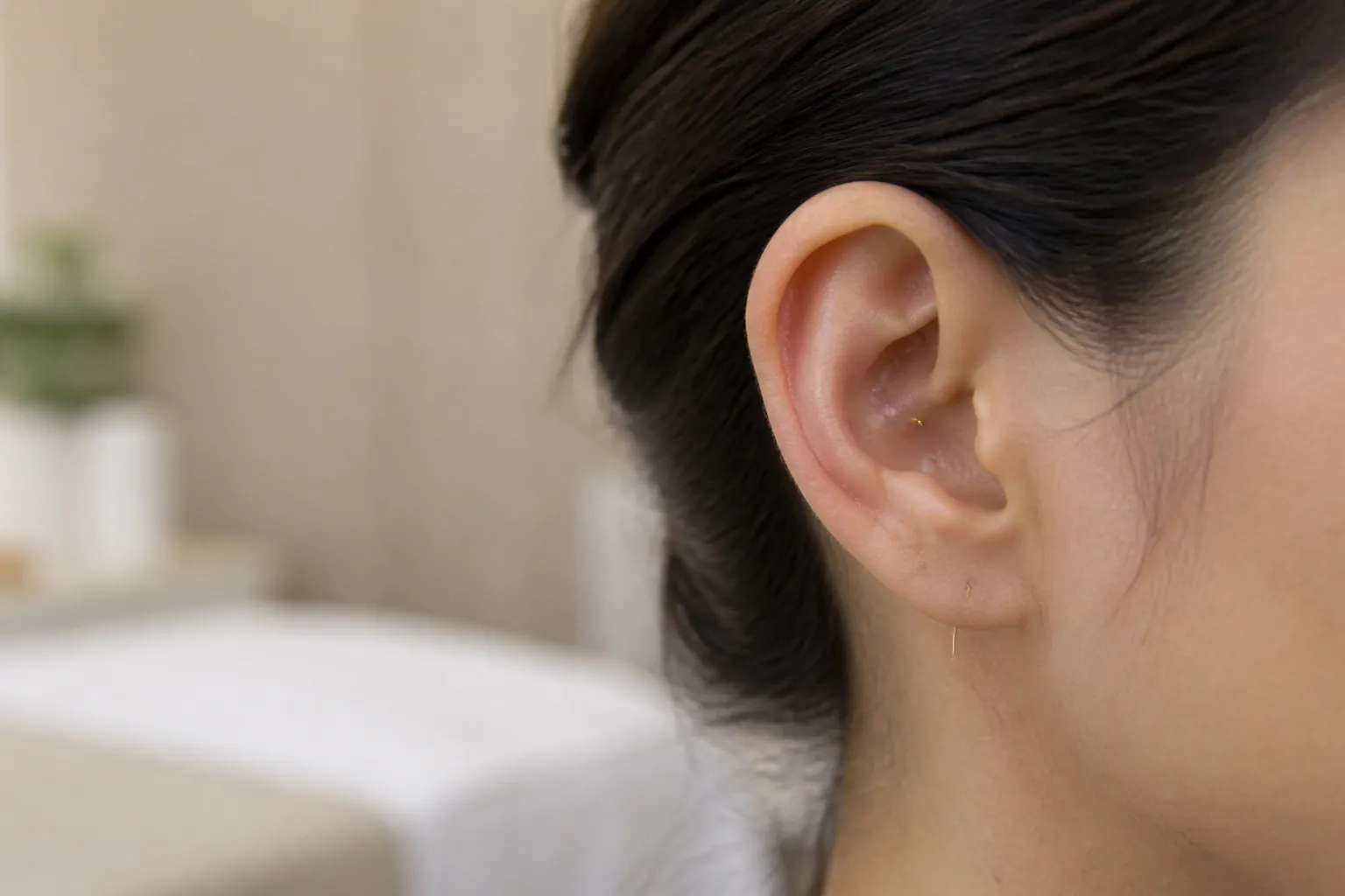 Ear acupuncture in a calm clinic
